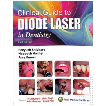 Clinical Guide To Diode Laser In Dentistry Peeyush